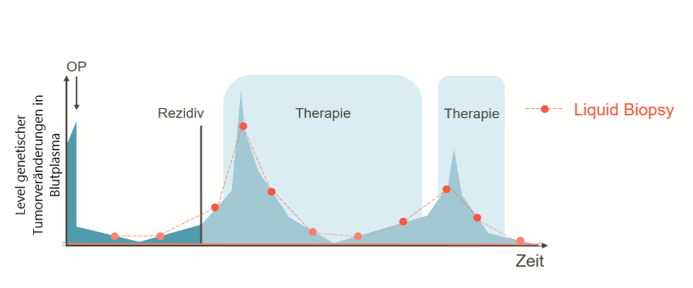 Liquid Biopsy